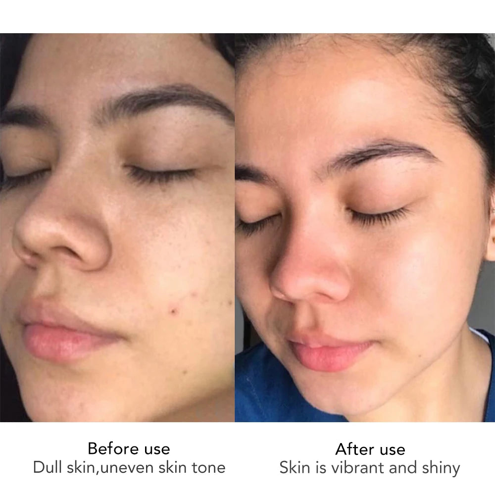 AILKE Hyaluronic Acid Face Cream Anti Aging Whitening Moisturizer