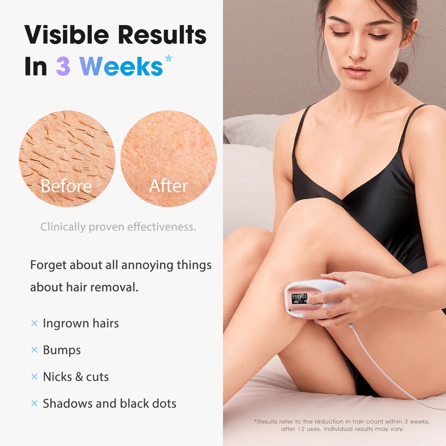 JOOYEE IPL Laser Hair Removal Device For Full Body Painless