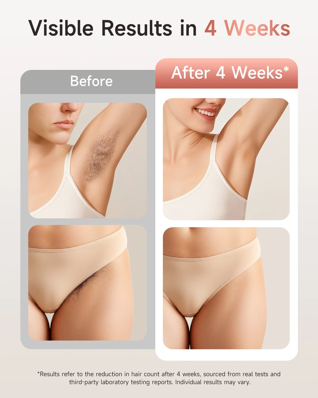 JOOYEE IPL Hair Removal With 9 Energy Levels For Body